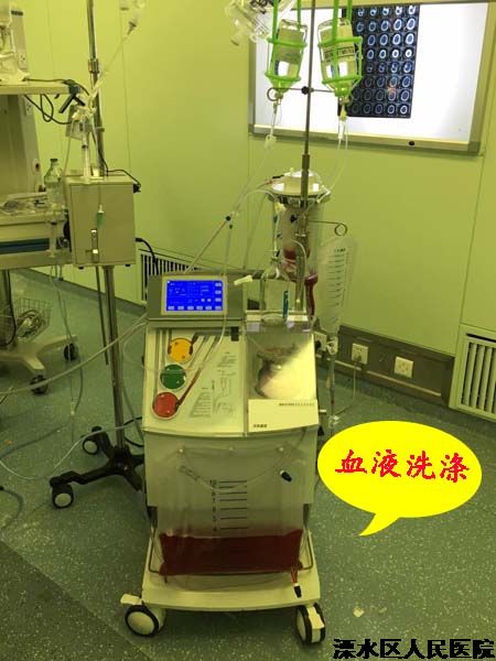 自体血回输  将流失的1000毫升血“抢”回来